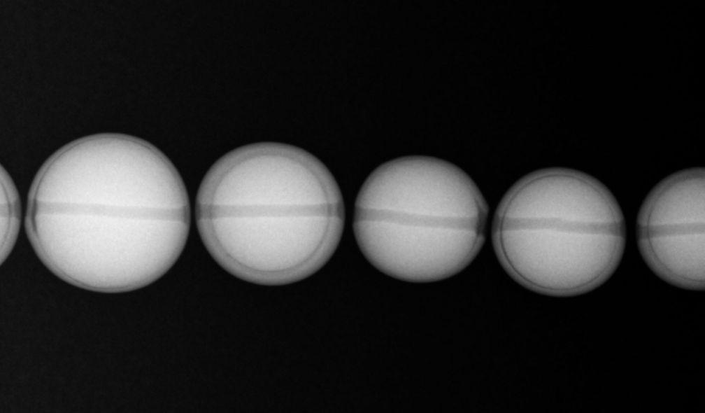 Cultured pearls seen under X-rays