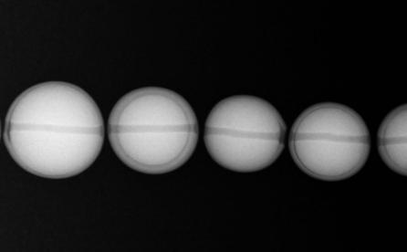 Cultured pearls seen under X-rays